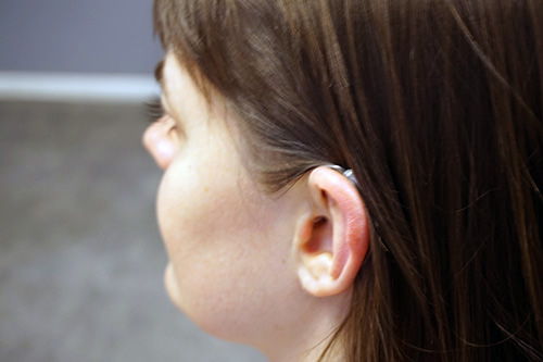 Utprovning av hörapparat