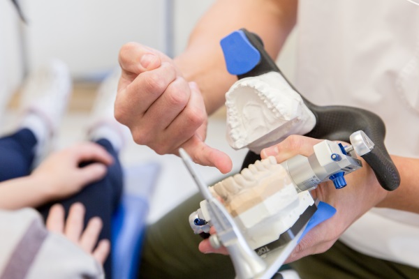 Tandläkare håller i en modell av tänder