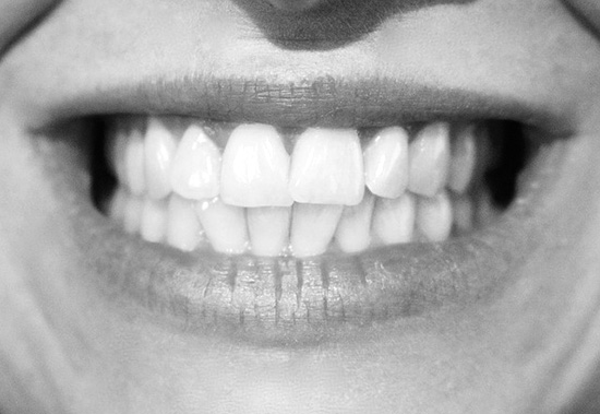 tandreglering-tänder